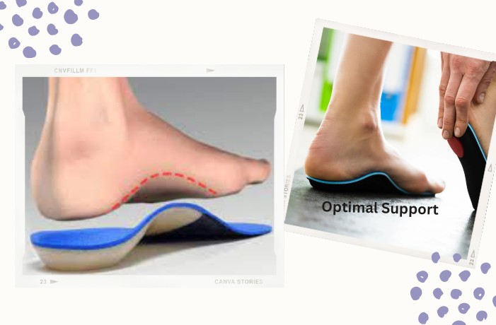 Arch support