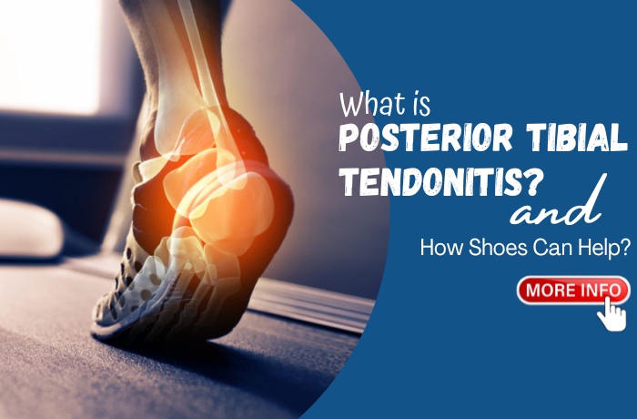 What is Posterior Tibial Tendonitis and How Shoes Can Help?